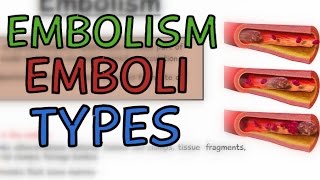 EMBOLISM EXPLAINED IN 2 MINUTES  WHAT IS AN EMBOLISM EMBOLUS  TYPES OF EMBOLI  5MINUTESCHOOL [upl. by Asira206]