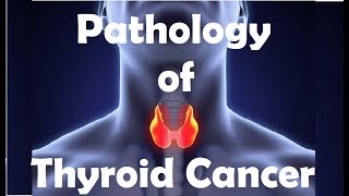 التشريح المرضي لأورام الغدة الدرقية 1  مختصر مع طريقة حفظ [upl. by Lizned]