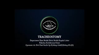 Adult Tracheostomy [upl. by Eolc551]