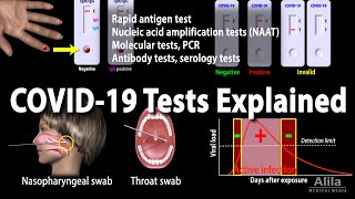 Understanding Different COVID19 Tests Animation [upl. by Donnenfeld]