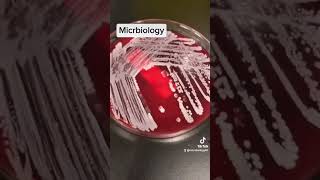 catalase test in microbiology [upl. by Pavia]