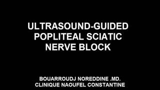 ULTRASOUND GUIDED POPLITEAL SCIATIC NERVE BLOCK [upl. by Enavi]