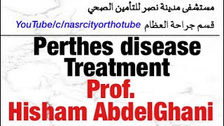 Perthes disease Treatment Prof Hisham AbdelGhani nasrcity online 2020 [upl. by Cathrine]