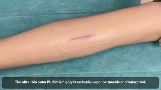 WOUND FREE Hydrogel Wound Dressings [upl. by Sarnoff]