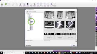 Training Apteryx XrayVision 4 Editing the Image Acquisition Date [upl. by Rhianon]