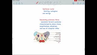 Lateral Medullary Syndrome Wallenburg syndrome PICA syndrome [upl. by Archibold]