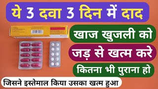 यह 3 दवा 3 दिन में दाद खाज खुजली को जड़ से खत्म करे  3 Best Medicine For Fungal Infection Problem [upl. by Yves]