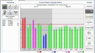 Virtual Electrodermal Screening TCM [upl. by Bethel]