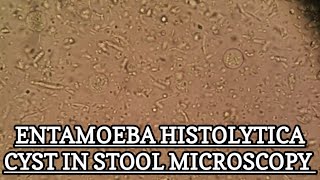 Entamoeba Histolytica Cyst under stool microscopy MLT WORLD [upl. by Marc768]