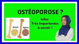 OSTEOPOROSE  Symptômes Causes Traitements  Expliqué Simplement [upl. by Vassily]