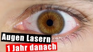 Meine Augen Laser Operation  Ein Jahr danach [upl. by Arlena]