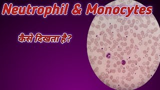 How to seen neutrophil  Lymohocytes  Monocytes under microscope [upl. by Rahab]