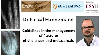 Guidelines in the management of fractures of phalanges and metacarpals [upl. by Beatrix]