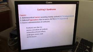 Endocrine DrHani Gamal Disturbance of adrenocortical hormones [upl. by Garibald]