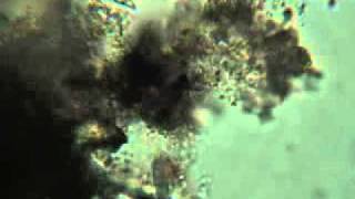 Fish Tank Filter Organisms Under a Microscopeflv [upl. by Miru]