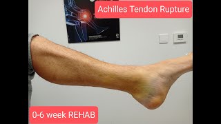 Achilles tendon rupture 06 week Rehabilitation protocol Riabilitazione rottura tendine dAchille [upl. by Erasmo]