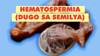 QampA HEMATOSPERMIA O DUGO SA SEMILYA  FAQ [upl. by Yleik835]