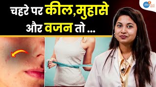 क्या आप भी इस बीमारी के शिकार तो नहीं  Lose Weight  PCOS Health  Dr Akanksha  Josh Talk Aasha [upl. by Aicxela]