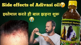 Side effects of Adivasi hair oil [upl. by Meehsar]