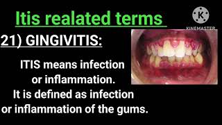 ITIS Related Terms Competativeexam GNM SINUSITIS GINGIVITIS MYOCARDITIS  The way of learning [upl. by Ethe]