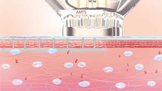 EPN Pen The Only Microneedling Device Combined with Electroporation Technology Giff [upl. by Malin]