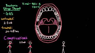 Tonsillopharyngitis Complications Diagnosis and Treatment [upl. by Adiahs211]