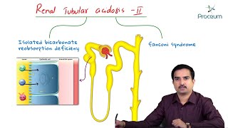 Fanconi syndrome  Proximal  Type 2  Renal Tubular Acidosis  Usmle [upl. by Mongeau]