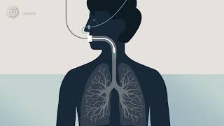 Bronchoscopy  examination of your airways English version [upl. by Nylac228]