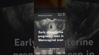 Early Intrauterine Pregnancy seen in transvaginal scan 5 weeks bestgynaecologist vizag ytshorts [upl. by Virgil]