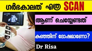 Scanning During Pregnancy Malayalam  How Often Side Effect [upl. by Debbra842]