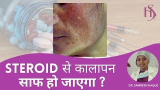 STEROID से कालापन साफ ​​हो जाएगा  STEROID Side Effect on Face  Dermatologist  Dr Samreen Haque [upl. by Anitsirhk]