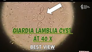 Giardia Lamblia cyst view at 40 XBest microscopic view of giardia cystgiardia parasite in stool [upl. by Chader]