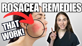 5 Rosacea Remedies THAT WORK  Dermatologist Tips [upl. by Kele]