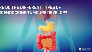 Symptoms Types and Diagnosis of Neuroendocrine Tumours NETs [upl. by Nnyre898]