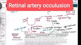 Retinal Artery Occlusion Guide  Opthalmology 15  First Aid USMLE Step 1 [upl. by Molini661]