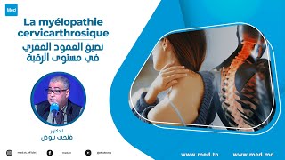 Dr Fethi Bayoudh  La myélopathie cervicarthrosique [upl. by Mcquillin]