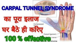 CARPAL TUNNEL SYNDROME TREATMENT Complete Cure  100  Effective Treatment Of CTS [upl. by Anirdua16]