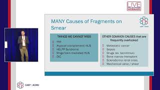 What is Thrombotic Microangiopathy TMA and Why Should I Care [upl. by Lunneta]