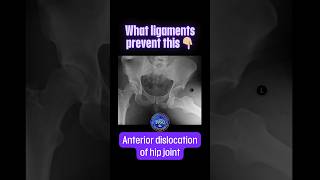 What ligaments prevent the anterior dislocation of hip joint shorts drsamsanatomyclasses [upl. by Karon]