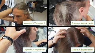 Sereni Capelli Hair Elixir impotriva parului alb si a caderii [upl. by Dey]