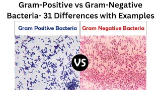 Gram Positive vs Gram Negative Bacteria 31 Differences with Examples [upl. by Airotnahs]