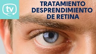 El tratamiento del desprendimiento de retina [upl. by Asserrac625]