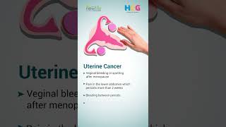 Gynecological Cancer Awareness Month  Dr Nikhil Mehta [upl. by Leonhard]