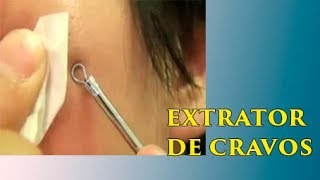 Removedor de Cravos e Acnes Profissional [upl. by Cirdec905]