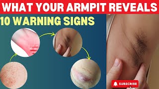 What Your Armpit Tells About Your Health 10 Warning Signs  Lump  Lymph Nodes  Painful Armpit [upl. by Bonilla724]