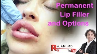 Permanent Lip Filler and OptionsDr Rajani [upl. by Yenatirb]