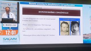 Dépistage néonatale de la phénylcétonurie et de lhypothyroïdie [upl. by Hiroko301]