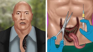 ASMR Help The Rock remove Venom from his navel  Satisfying [upl. by Stefano598]