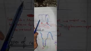 HISTOLOGY OF SMALL INTESTINE [upl. by Baese379]