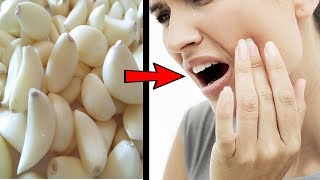 10 Home and Natural Remedies for Toothache Pain [upl. by Holbrook]